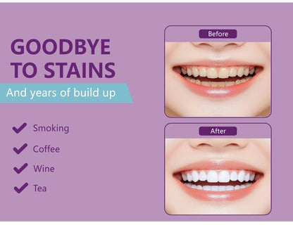 Natural Coconut Whitening Strips