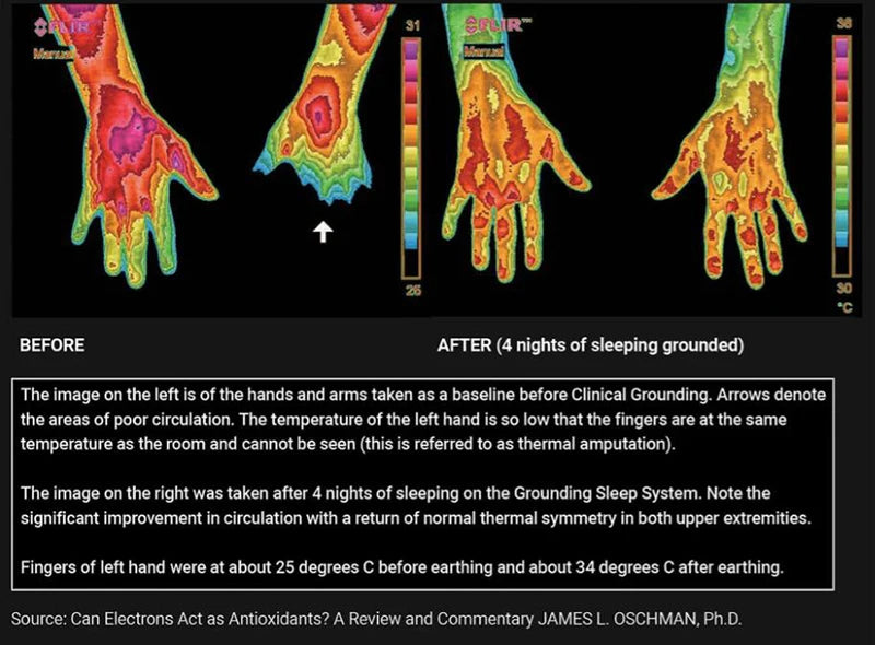 Grounding & Earthing Mat