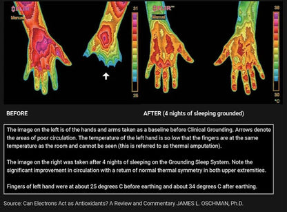 Grounding & Earthing Mat