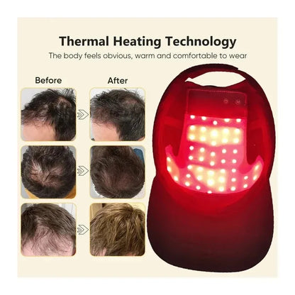 Red Light Therapy Cap