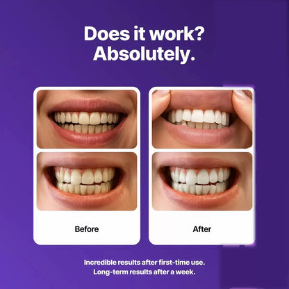 Natural Coconut Whitening Strips